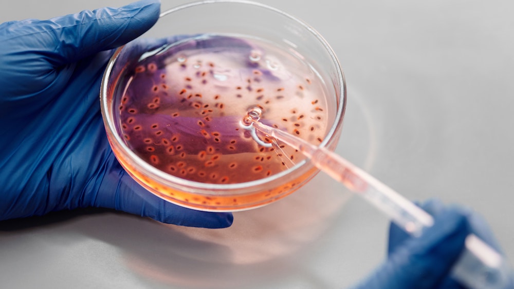 clase particulares Murcia Grado de Biotecnologia